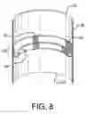 Fig. 09 - Endoluminal Prosthetic Conduit Systems and Method of Coupling