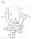 Fig. 02 - Artificial knee joint