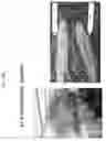 Fig. 23 - PLANTS WITH ALTERED ROOT ARCHITECTURE, INVOLVING THE RT1 GENE, RELATED CONSTRUCTS AND METHODS