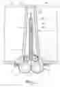 Fig. 04 - Compact Drain Assembly for Sinks and the Like
