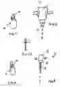 Fig. 02 - OPHTHALMIC PUMP ASSEMBLY