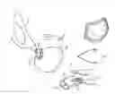 Fig. 01 - VENT AND STRAP FASTENING SYSTEM FOR A DISPOSABLE RESPIRATOR