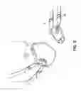 Fig. 06 - VENT AND STRAP FASTENING SYSTEM FOR A DISPOSABLE RESPIRATOR