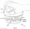 Fig. 04 - Food cutting device