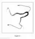 Fig. 05 - Method and apparatus for initiating subsequent exposures based on determination of motion blurring artifacts
