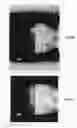 Fig. 08 - Computerized tomography image reconstruction