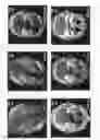 Fig. 09 - Computerized tomography image reconstruction