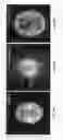 Fig. 10 - Computerized tomography image reconstruction