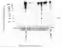Fig. 01 - Antibodies for oncogenic strains of HPV and methods of their use