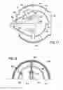 Fig. 07 - Ventilation means with orientation and flow rate adjustment obtained by rotating a profiled body