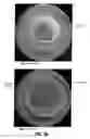 Fig. 07 - Image-based path planning for automated virtual colonoscopy navigation