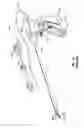 Fig. 02 - Electrically conductive/insulative over shoe for tissue fusion