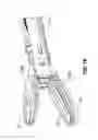 Fig. 09 - Electrically conductive/insulative over shoe for tissue fusion