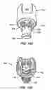 Fig. 07 - MIS crosslink apparatus and methods for spinal implant
