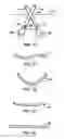 Fig. 44 - MIS crosslink apparatus and methods for spinal implant