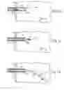 Fig. 09 - MEDICAL PROBE INTRODUCER