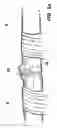 Fig. 06 - Device and method for assisting in flexor tendon repair and rehabilitation