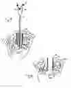 Fig. 09 - Apparatus and methods for performing brain surgery