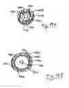 Fig. 17 - Apparatus and methods for performing brain surgery