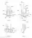 Fig. 02 - Apparatus and methods for attaching soft tissue to bone