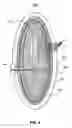Fig. 08 - Medical electrode systems and methods