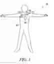 Fig. 02 - MEDICAL DEVICE HAVING PLASMA POLYMERIZED COATING AND METHOD THEREFOR