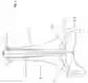 Fig. 04 - Plunger with disposable cover