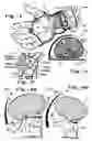 Fig. 02 - Wrist-actuated beverage-container opener