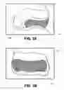 Fig. 04 - Adhesive nasal respiratory devices