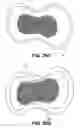 Fig. 26 - Adhesive nasal respiratory devices