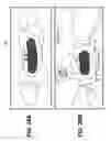 Fig. 29 - Adhesive nasal respiratory devices