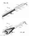 Fig. 03 - NASAL CATHETER WITH INTERNAL AND EXTERNAL AIR FLOWS