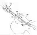 Fig. 01 - APPARATUS AND METHOD FOR INTUBATING AN AIRWAY OF A PATIENT