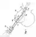 Fig. 02 - APPARATUS AND METHOD FOR INTUBATING AN AIRWAY OF A PATIENT