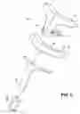 Fig. 04 - WALKER WITH UNDERARM SUPPORTS