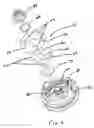 Fig. 04 - Suspension damping valve