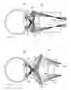 Fig. 04 - Real image forming eye examination lens utilizing two reflecting surfaces