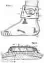 Fig. 02 - Motion-responsive illuminated stocking