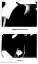 Fig. 04 - TARGET FOIL FOR USE IN THE PRODUCTION OF [18F] USING A PARTICLE ACCELERATOR