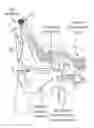 Fig. 01 - Bone conduction hearing device with open-ear microphone