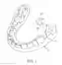 Fig. 07 - Bone conduction hearing device with open-ear microphone