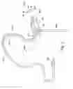 Fig. 03 - Non-occluding audio headset positioned in the ear canal