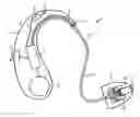 Fig. 01 - Automatic identification of receiver type in hearing aid devices