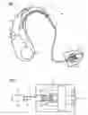 Fig. 02 - Automatic identification of receiver type in hearing aid devices