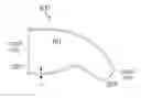 Fig. 01 - HEARING AID SLEEVE