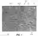 Fig. 02 - System and method for counting follicular units