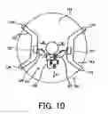 Fig. 07 - Aligner