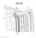 Fig. 06 - METHOD AND APPARATUS FOR CLEARANCE CONTROL OF TURBINE BLADE TIP