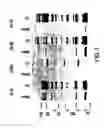 Fig. 02 - protein, nucleic acid sequence and uses thereof