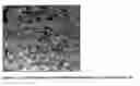 Fig. 02 - SILICONE VESICLES CONTAINING ACTIVES
